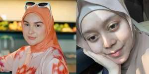 10 Penampilan Asli Artis Saat Tanpa Makeup, Irish Bella Pede Meski Wajahnya Berjerawat!