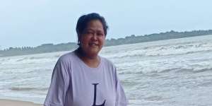 Penyebab Kaki Suti Karno Diamputasi Dua Bulan Lalu