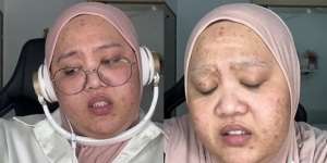 10 Transformasi Makeup Wanita Berjerawat Parah, Jadi Cantik Tirus Bak Boneka Barbie, Bikin Pangling!