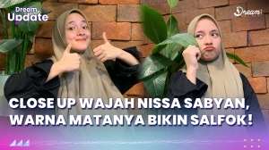 Close Up Wajah Nissa Sabyan, Warna Matanya Bikin Salfok!