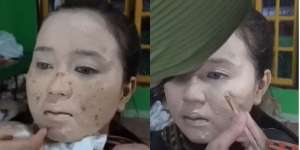MUA Ungkap Trik Rias Wajah Beruntusan, Hasilnya Super Flawless