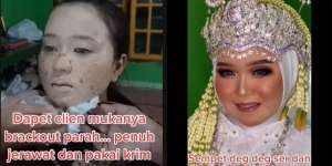 Potret Transformasi Makeup Pengantin yang Alami Jerawat Parah, Hasil Riasannya Bikin Melongo!