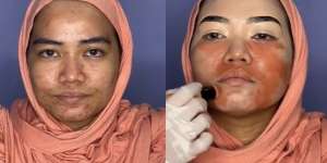 Semula Banyak Jerawat, Potret Pengantin Wanita yang Wajahnya Disulap Seperti Barbie!