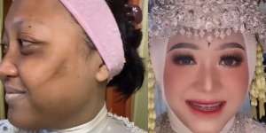 Before-After Riasan Pengantin, Warganet 'Bagai Langit dan Bumi'