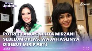 Potret Lawas Nikita Mirzani Sebelum Oplas, Wajah Aslinya Disebut Mirip ART!