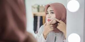 Jerawat Sering Meninggalkan Bekas? 4 Hal Ini Bisa Dilakukan untuk Pencegahan