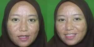 Wanita Penuh Jerawat Meradang & Bopeng Dirias MUA Jadi Pengantin, Hasilnya Bikin Kaget!