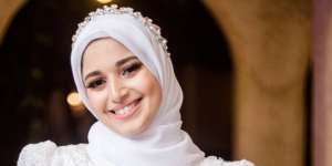 Hindari Jajal Skincare Baru Jelang Pernikahan, Sudah Tahu Alasannya?