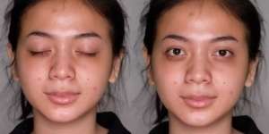 Wanita Dengan Bekas Jerawat Dimakeup MUA Ala Barbie, Hasilnya Bikin Lupa Wajah Aslinya