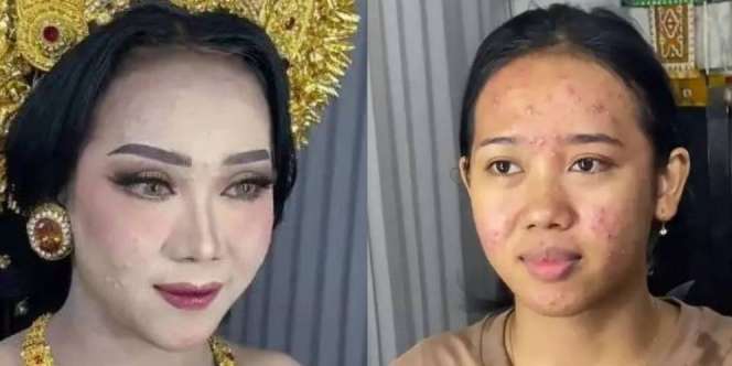 Potret Transformasi Pengantin Wanita Berjerawat Diubah MUA 'Skill Tingkat Dewa', Hasilnya Bikin Auto Melongo yang Lihat!