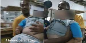 Viral Bayi Satu Tahun Beratnya 25 Kg