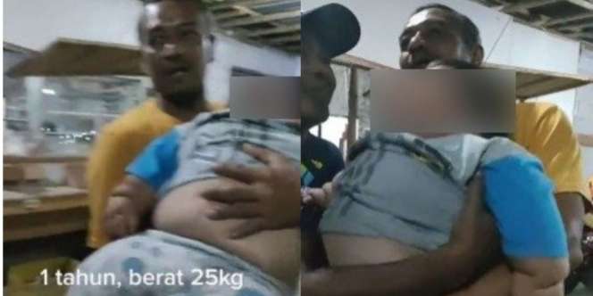Viral Bayi Satu Tahun Beratnya 25 Kg