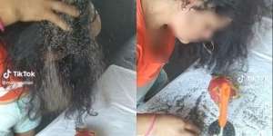 Merinding! Rambut Wanita jadi Sarang Kutu, Sekali Kibas Rontok Kayak Pasir