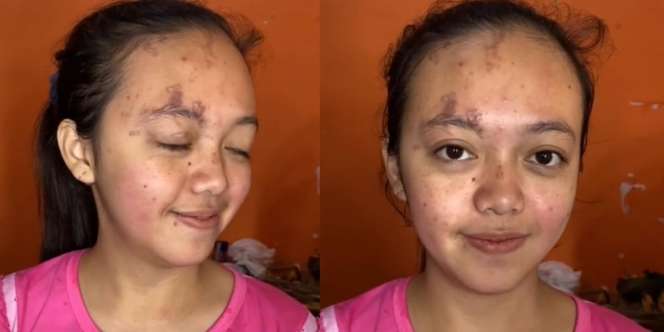 Panik Dapat Cobaan Sakit Kulit Jelang Pernikahan, Pengantin Wanita Akhirnya Bisa Senyum Usai Dimakeup dengan Hasil Flawless Habis