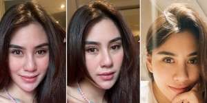 6 Potret Penampilan Dulu VS Sekarang Syahnaz Sadiqah, Bagian Hidung Bikin Pangling