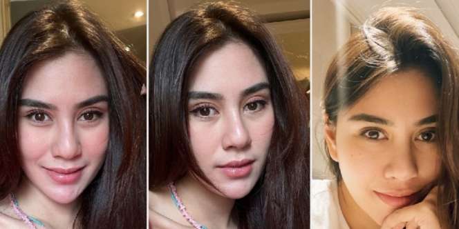6 Potret Penampilan Dulu VS Sekarang Syahnaz Sadiqah, Bagian Hidung Bikin Pangling