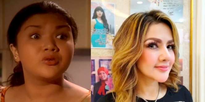 Dulu Dibenci jadi Pembantu Jahat, Wajah ART Lala di Sinetron Bidadari Berubah Total Sehabis Oplas