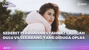 Penampilan Baru Syahnaz Sadiqah yang Diduga Oplas