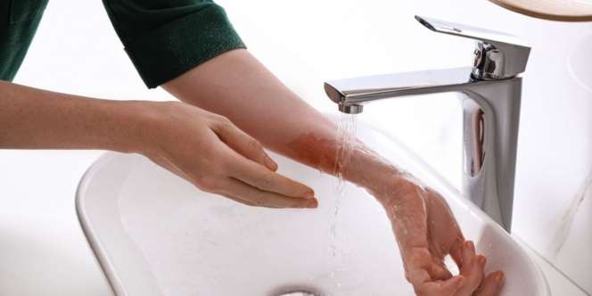 Cek Fakta: Tepung Terigu Bisa Jadi Pertolongan Pertama Luka Bakar