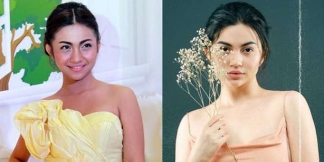 11 Potret Artis Disebut Oplas Karena Wajahnya Terlihat Beda, Adik Raffi Ahmad Berubah Banget!