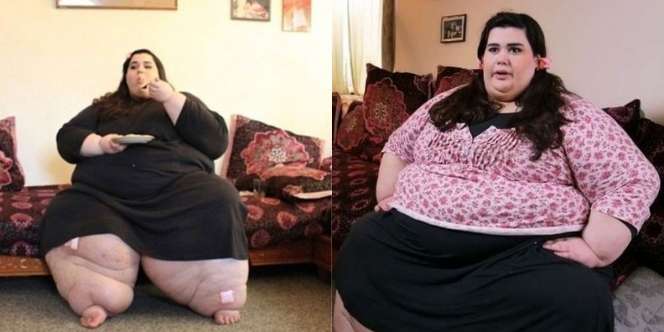Pernah Berbobot 317 Kg dan Diagnosis hanya Hidup sampai Umur 30 Tahun, Penampilan Terbaru Wanita Ini Setelah Diet Bikin Melongo