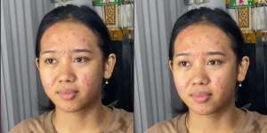 Potret Transformasi Makeup Pengantin yang Alami Jerawat Parah, Awalnya Bikin Deg-degan, Endingnya Malah Bikin Syok!