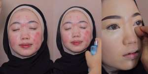 Transformasi Makeup Wajah Berjerawat Parah Jadi Natural dan Flawless