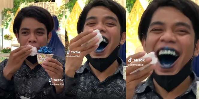 Ngakak! Gara-gara Makan Cupcake, Bibir dan Gigi Pemuda Ini Langsung Membiru Jadi Seperti Jagoan Neon