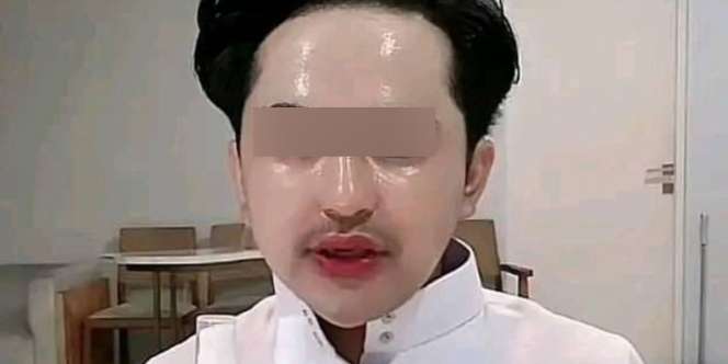 Kulit Wajah Pria Ini Kelewat Glowing Seperti Dilaminating
