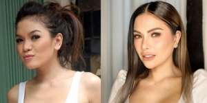 12 Potret Before VS After Artis Lakukan Operasi Hidung, Terbaru Ada Jessica Iskandar, Tuai Cibiran!