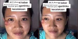 Potret Makeup Pengantin Usai Alami Kecelakaan, Hasilnya Malah di Luar Dugaan, MUA Auto Panik!