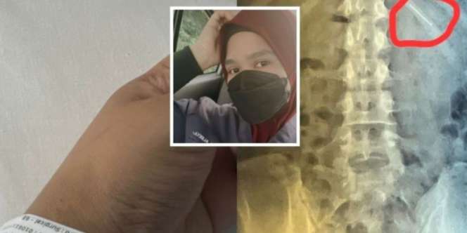 Innalillahi! Hendak Pakai Jilbab, Wanita Ini Tak Sengaja Telan Jarum Pentul, Begini Akhir Kisahnya