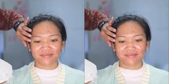 Pengantin Wajah Berjerawat Ini Berhasil Dirias Manglingi, Ternyata Ini Rahasia Sang MUA…