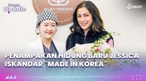 Penampakan Hidung Baru Jessica Iskandar 