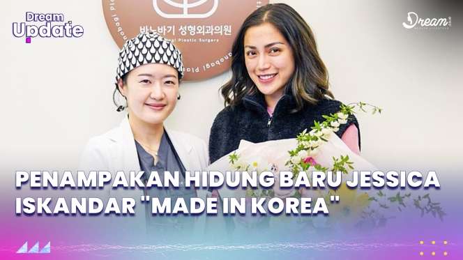 Penampakan Hidung Baru Jessica Iskandar 