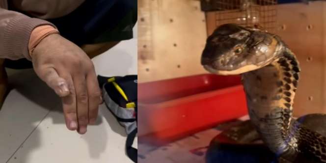Jari Kelingking Digigit King Kobra Hitam Sampai Bengkak dan Pucat Saat Kasih Minum, Panji Petualang Nyaris Tidak Bisa Lebaran