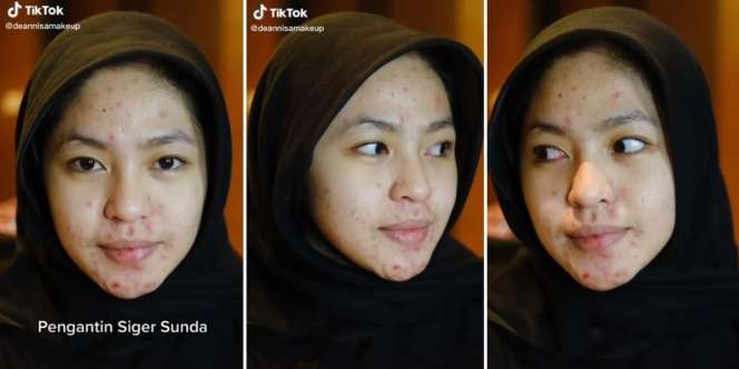 Transformasi Makeup Pengantin Siger Sunda Penuh Jerawat di Wajah, Aslinya Cantik Kini Terlihat Natural dan Tambah Cetar