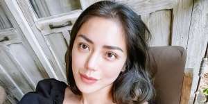 Dulu Dihujat, Begini Penampilan Wajah Jessica Iskandar Usai Operasi Hidung yang Dipuji Makin Cantik