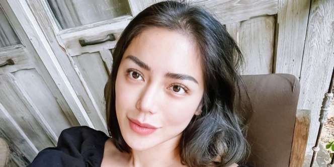 Dulu Dihujat, Begini Penampilan Wajah Jessica Iskandar Usai Operasi Hidung yang Dipuji Makin Cantik