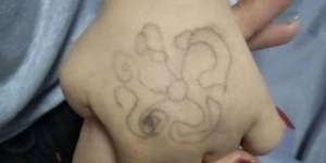 Ibu Curiga Lihat Gambar dengan Pola Aneh di Tangan Putrinya, Fakta Ngeri Terungkap Usai Hubungi Polisi