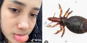 Bibir Wanita Cantik Ini Jadi Serem Banget Gegara Hewan Imut Ini