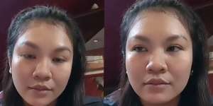 Ingat Dokter Cantik Mantan Istri Aldi Taher? Dulu Cerai pas Hamil, Kini Parasnya Berubah Drastis