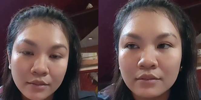 Ingat Dokter Cantik Mantan Istri Aldi Taher? Dulu Cerai pas Hamil, Kini Parasnya Berubah Drastis
