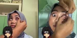 Wanita Ini Pasang Mata Sharingan ala Anime Naruto, Ternyata Ada Kisah Haru Dibaliknya, Netizen: `Berdamai dengan Diri Sendiri`