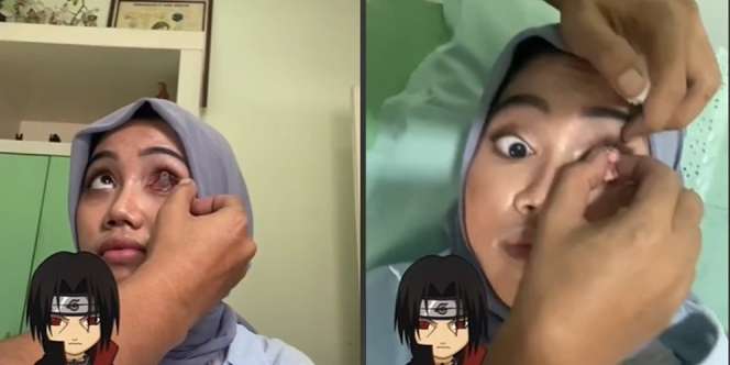 Wanita Ini Pasang Mata Sharingan ala Anime Naruto, Ternyata Ada Kisah Haru Dibaliknya, Netizen: `Berdamai dengan Diri Sendiri`