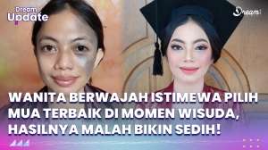 Wanita Berwajah Istimewa Pilih MUA Terbaik di Momen Wisuda, Hasilnya Malah Bikin Sedih!