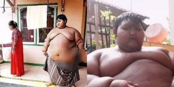 Masih Ingat Arya Permana Bocah Seberat 190 Kg? Dulu Sosoknya Viral Kini Penampilan Terbarunya Bikin Pangling, Netizen: `Kayak Beda Orang`