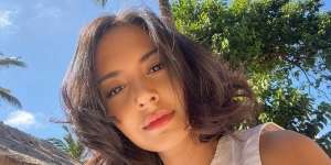 Aurelie Moeremans Tak Bisa Tersenyum Selama 6 Bulan Gara-gara Suntikan Tumor Colli