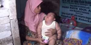 Setelah Fajri Tangerang, Bayi di Bekasi Alami Obesitas, Umur 7 Bulan Bobotnya 15,5 Kg