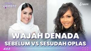 Wajah Denada Sebelum VS Sesudah Oplas